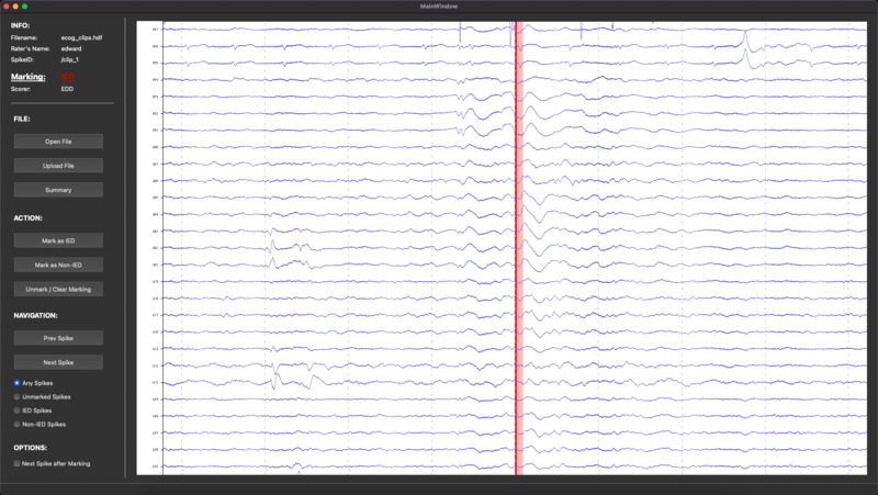 An image of the Interictal Spike Rater project